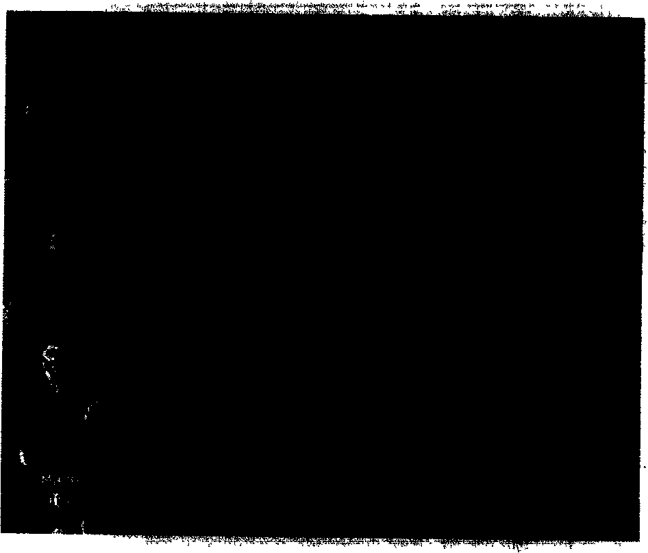 Tourmaline/titanium dioxide composite collosol containing rare earth and its preparation method and uses