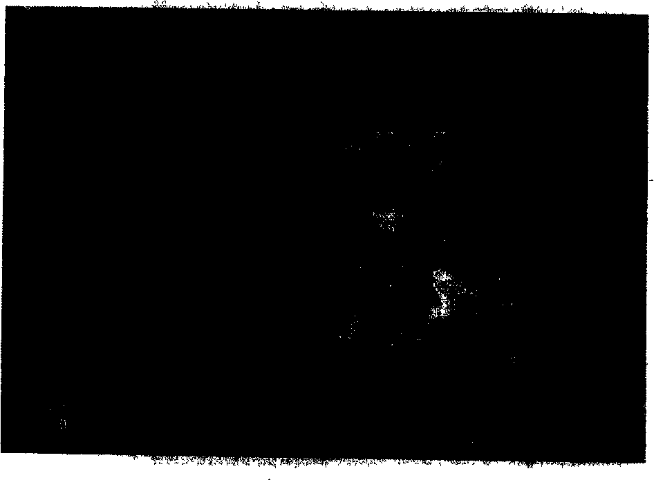 Tourmaline/titanium dioxide composite collosol containing rare earth and its preparation method and uses