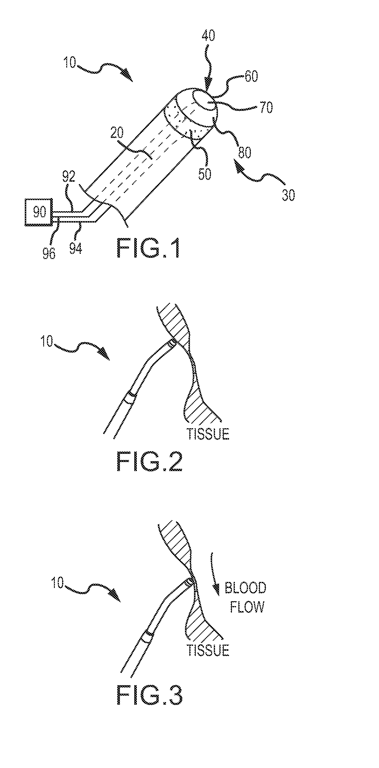 Anatomical thermal sensing device and method