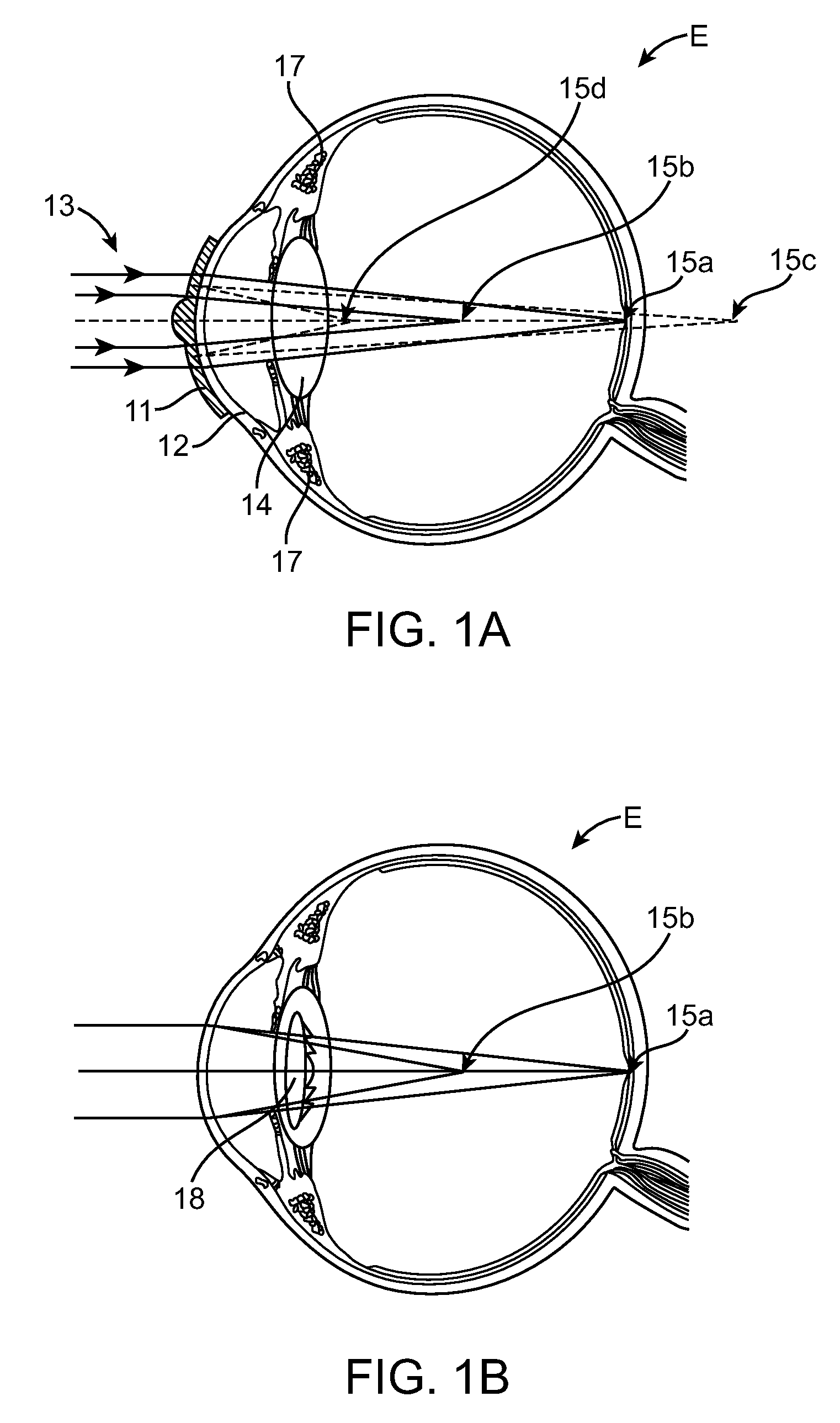 Diffractive Multifocal Lens Having Radially Varying Light Distribution