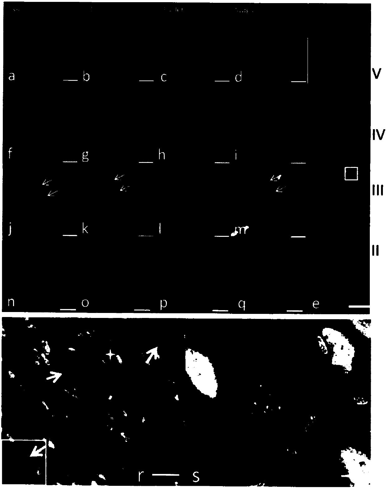 Novel growth/neurotrophic factor composition for inducing mature neuron division in vivo and purpose thereof