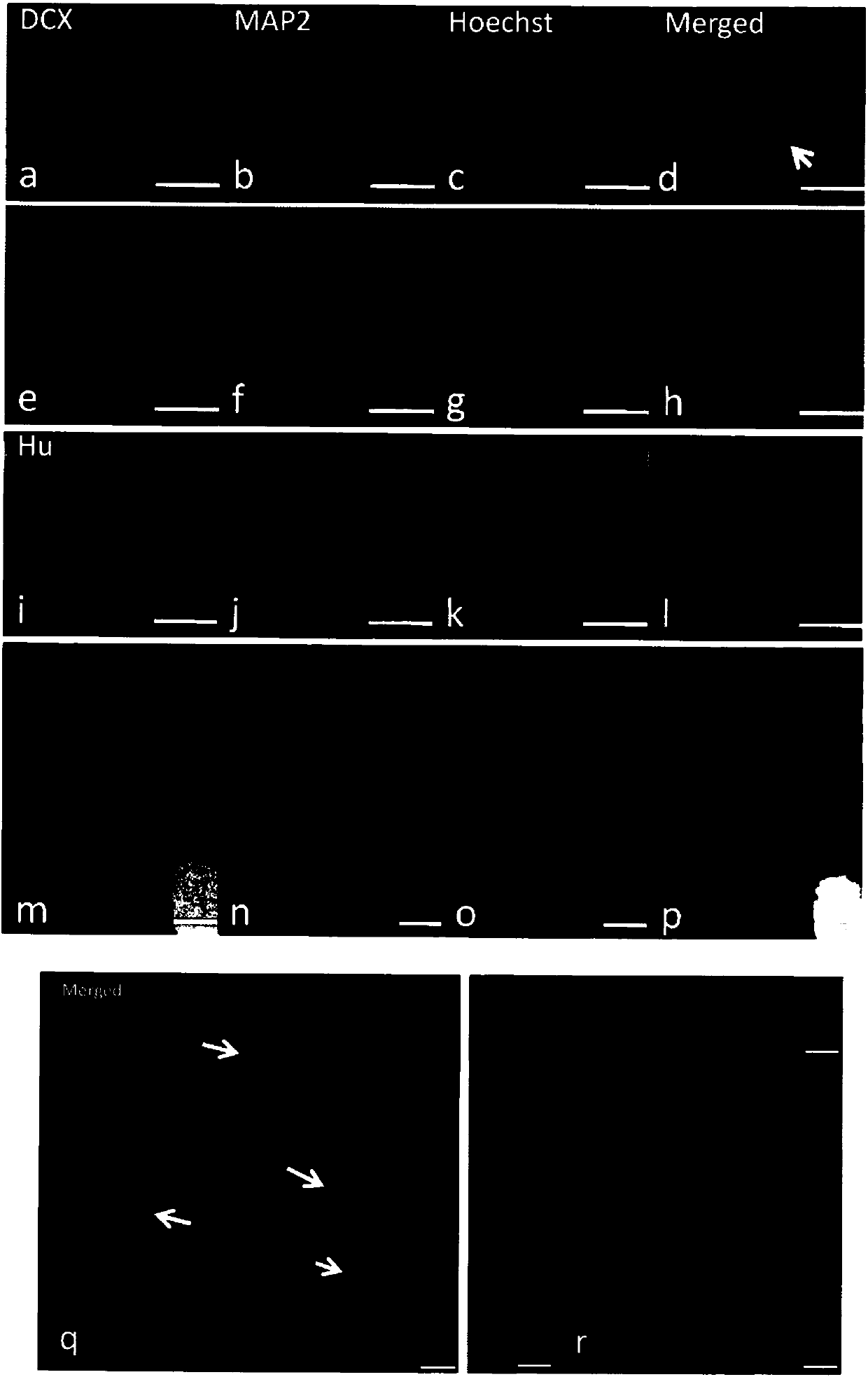 Novel growth/neurotrophic factor composition for inducing mature neuron division in vivo and purpose thereof