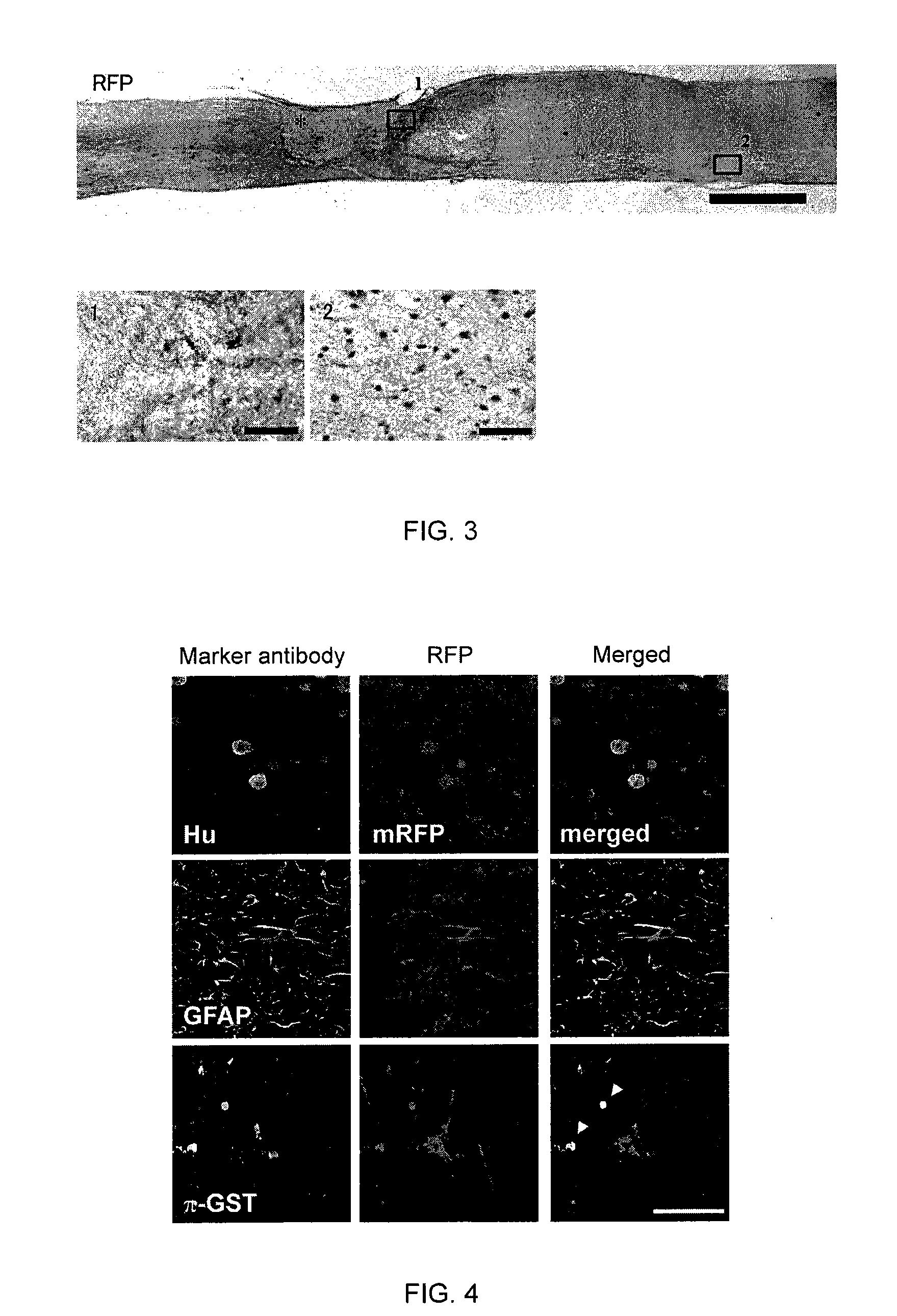 Method of treating neural defects