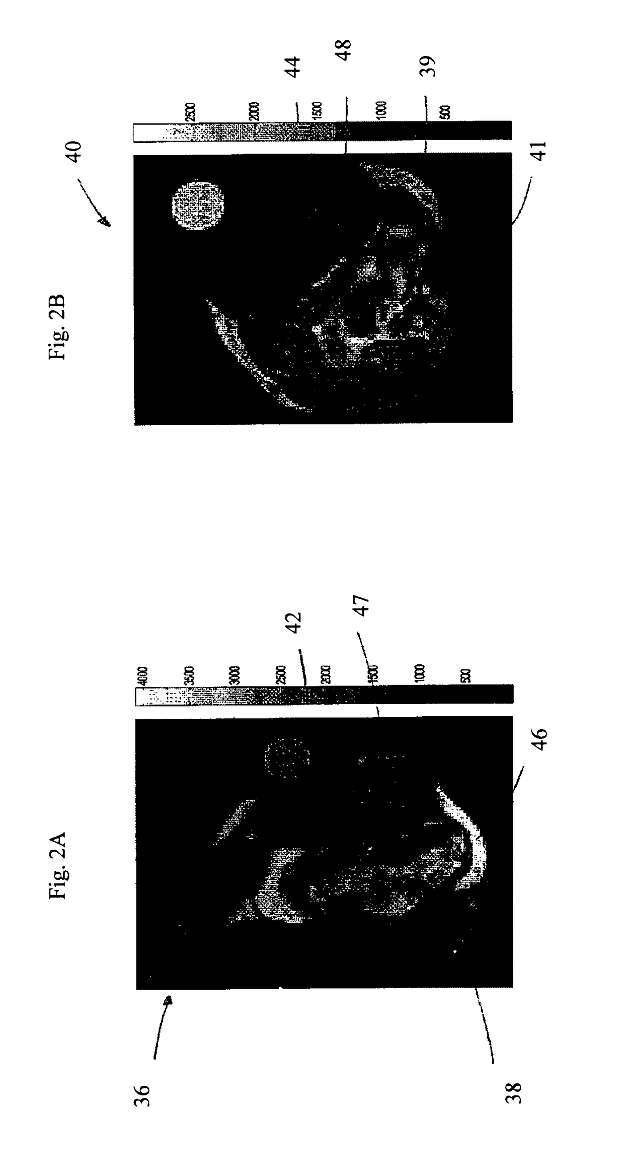 Method for providing high resolution, high contrast fused MRI images