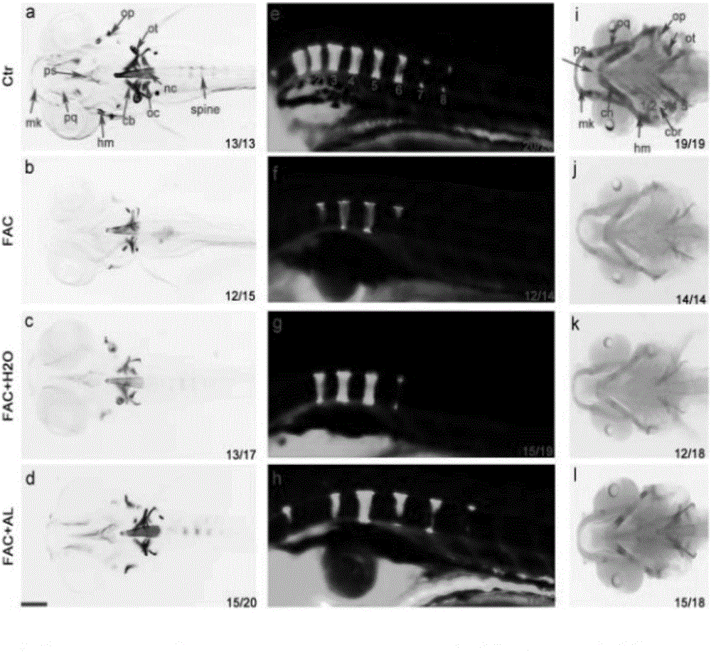 Method of preparing osteoporosis model of zebra fish and alizarin red dyeing method thereof