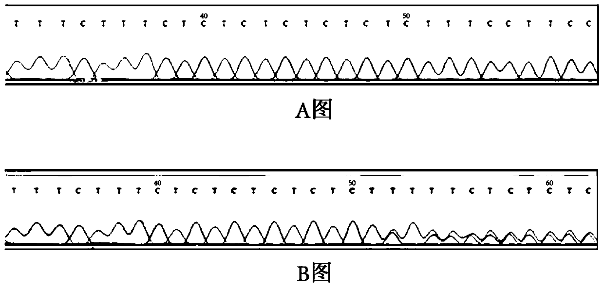 Variation site of obstructive sleep apnea hypopnea syndrome susceptibility gene adipoq and its detection method and application