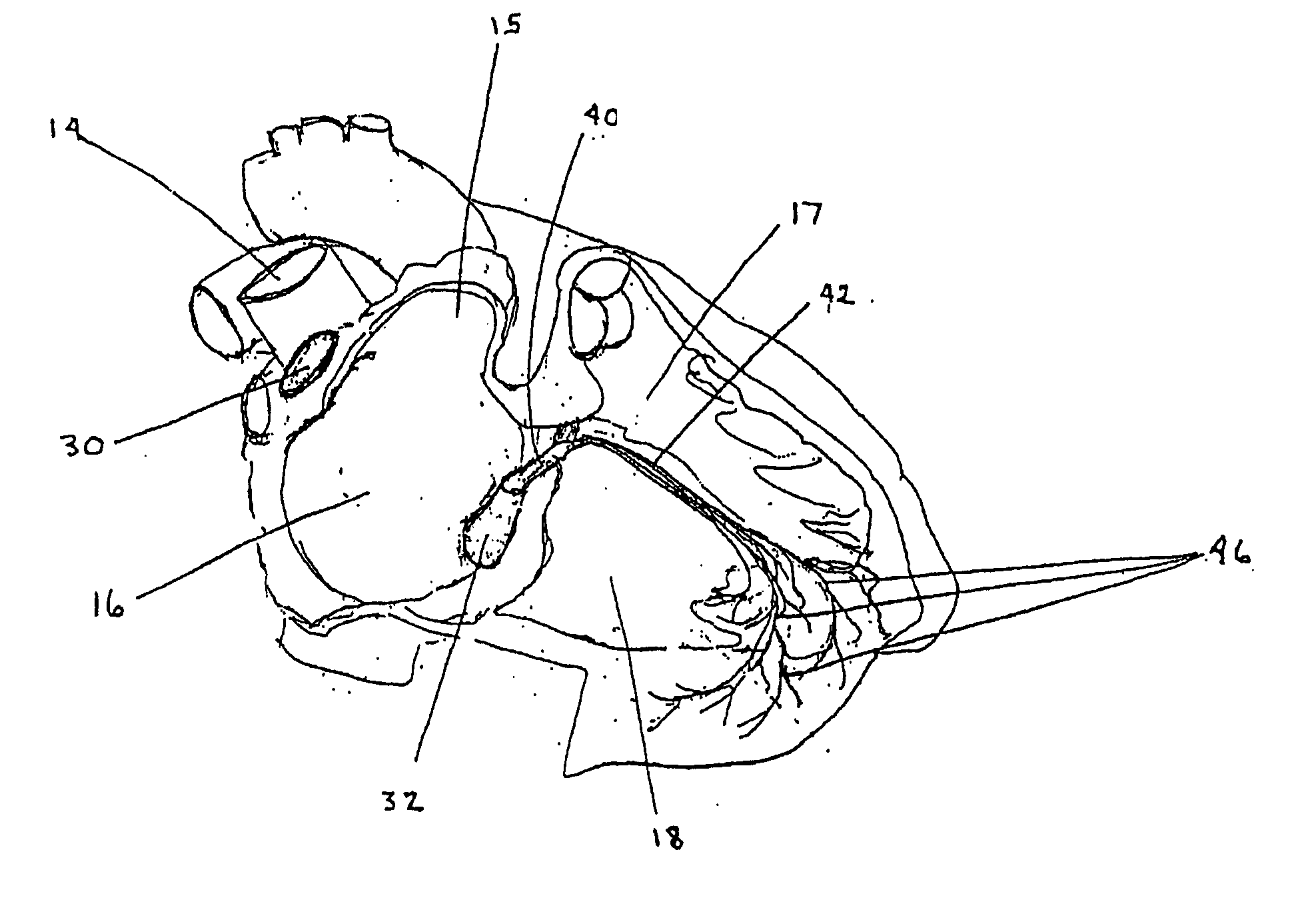 Compositions and methods for treating cardiac dysfunction