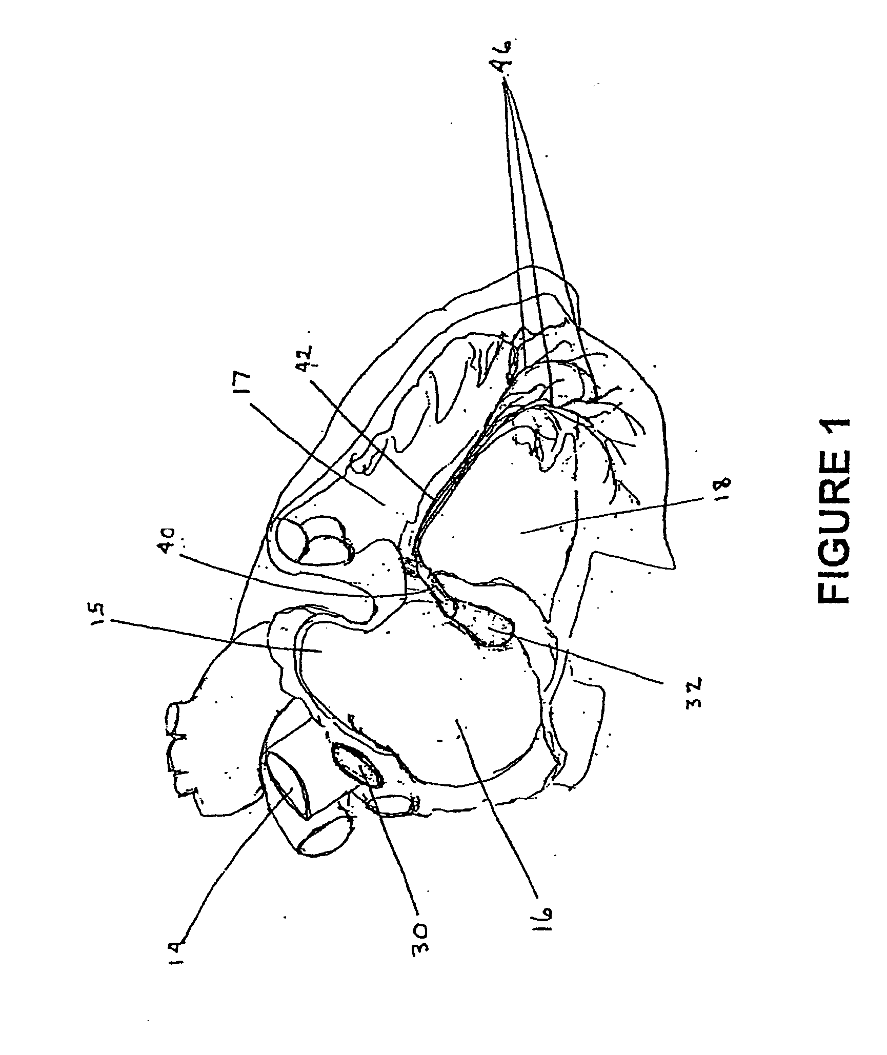 Compositions and methods for treating cardiac dysfunction