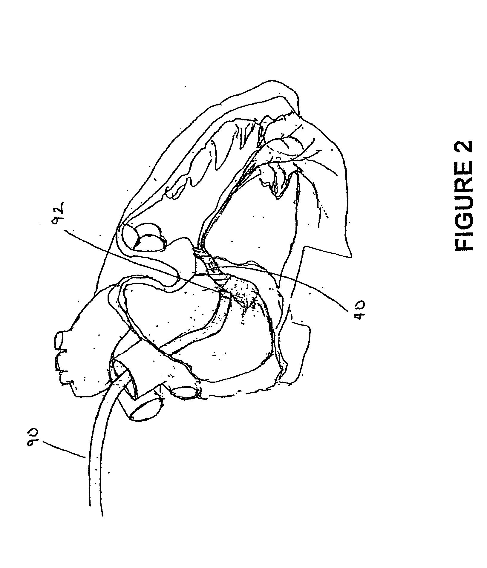 Compositions and methods for treating cardiac dysfunction