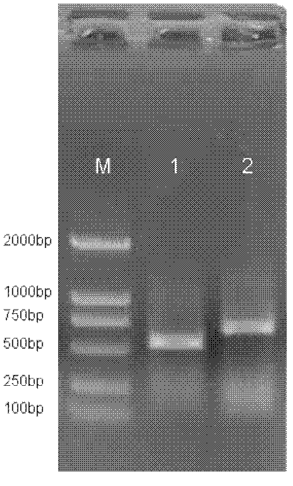 Human-mouse chimeric monoclonal antibody against human platelet membrane glycoprotein Ib alpha and applications of human-mouse chimeric monoclonal antibody