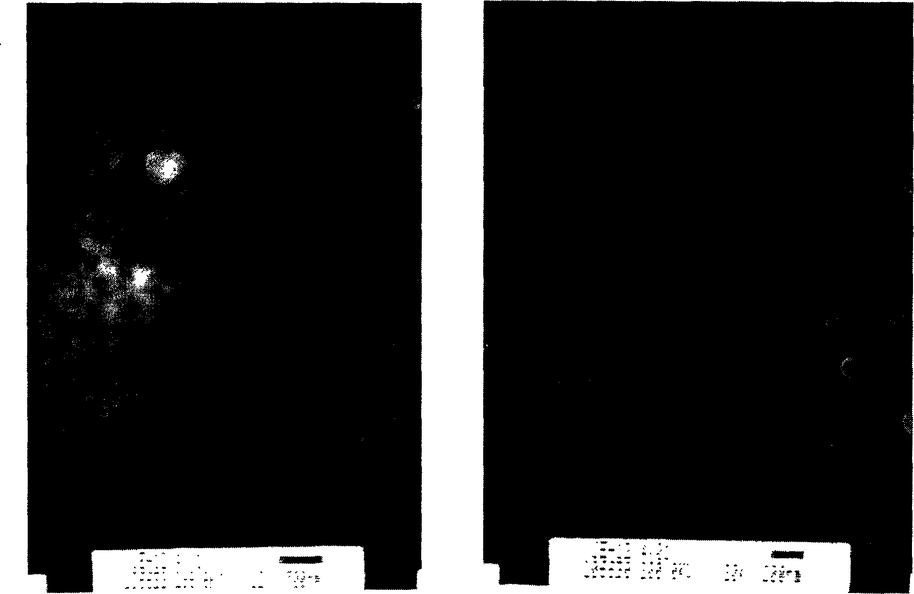 Biological degradable macromolecule microspheres of carrying insulin and preparation method