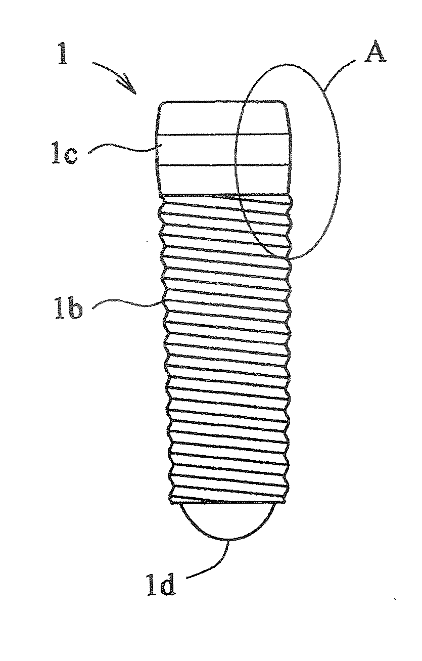 Dental implant