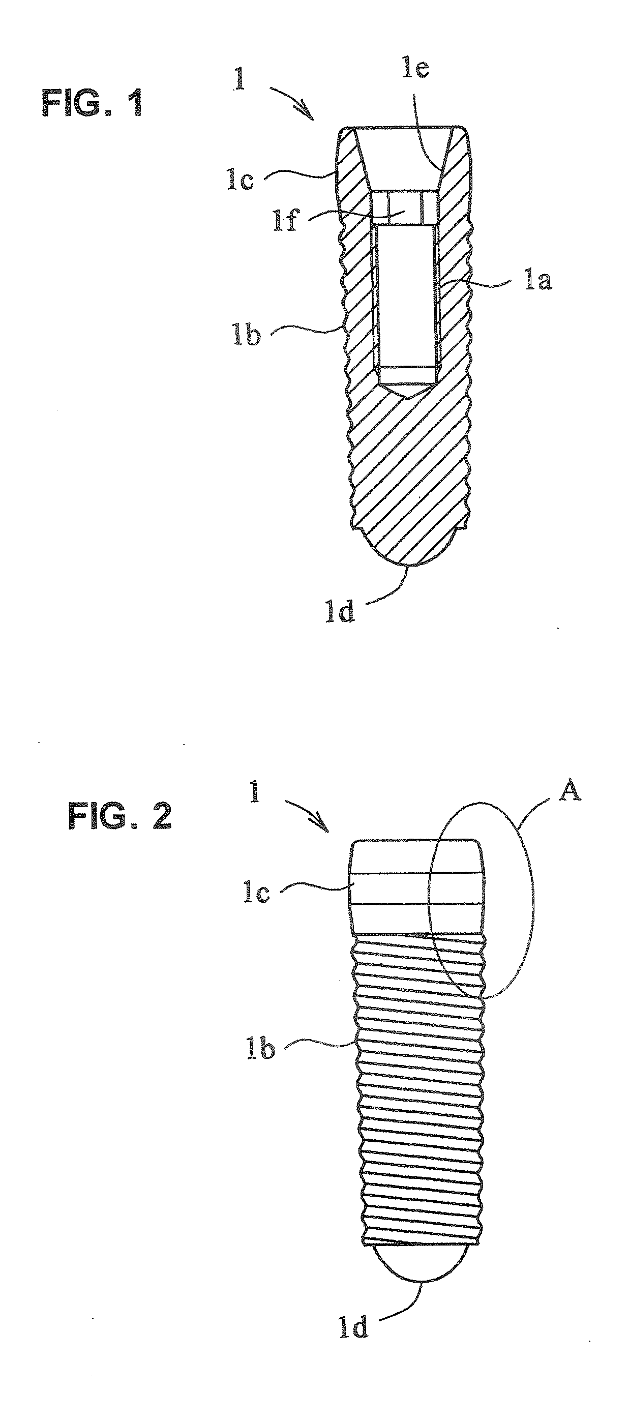 Dental implant