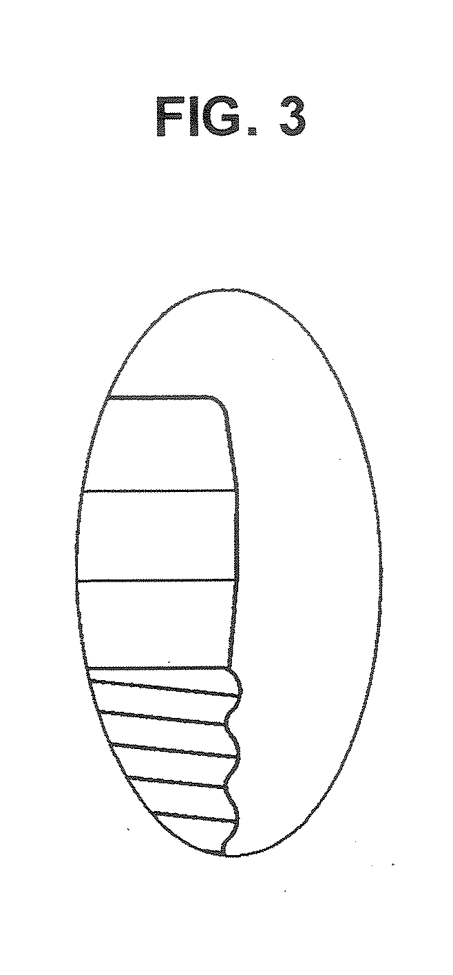 Dental implant