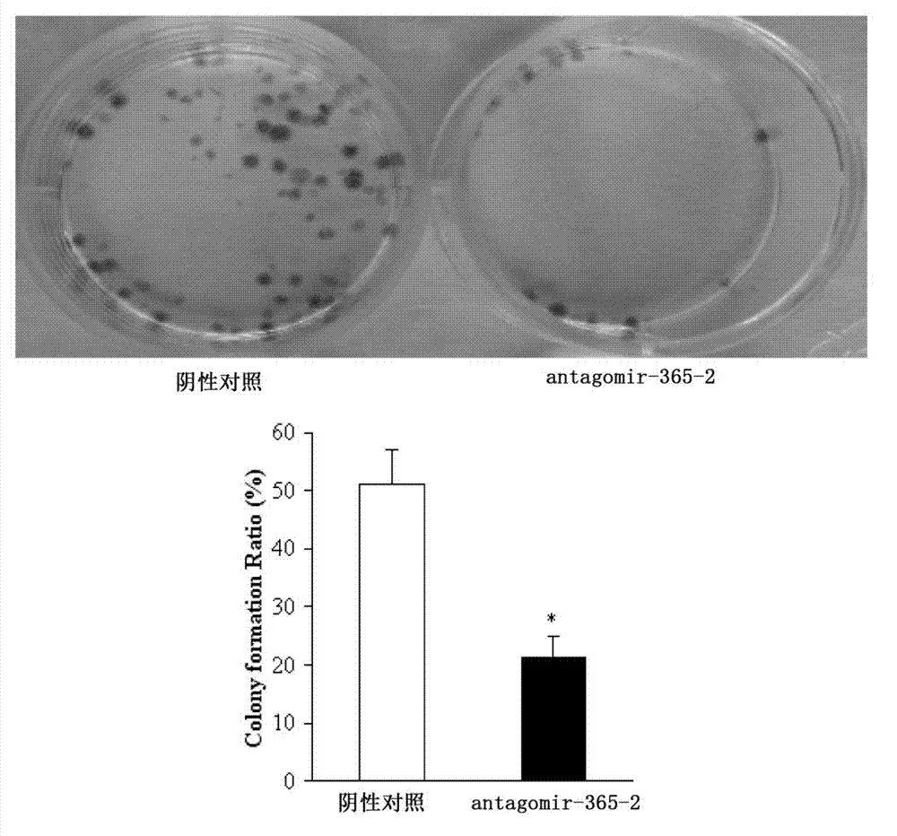 Anti-skin squamous cell carcinoma medicament, i.e., antagomir-365-2