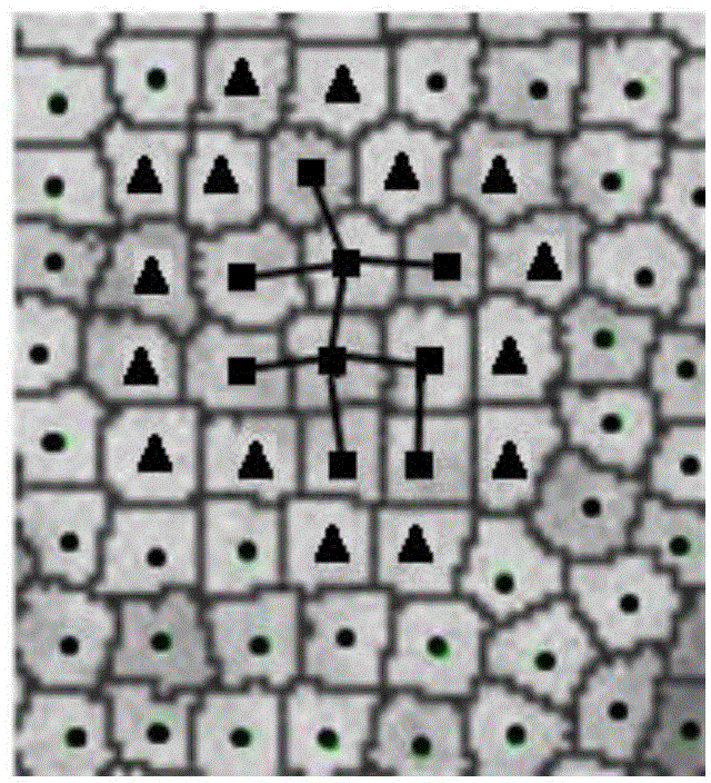 Region growth ultrasound image automation segmentation method based on energy constraint