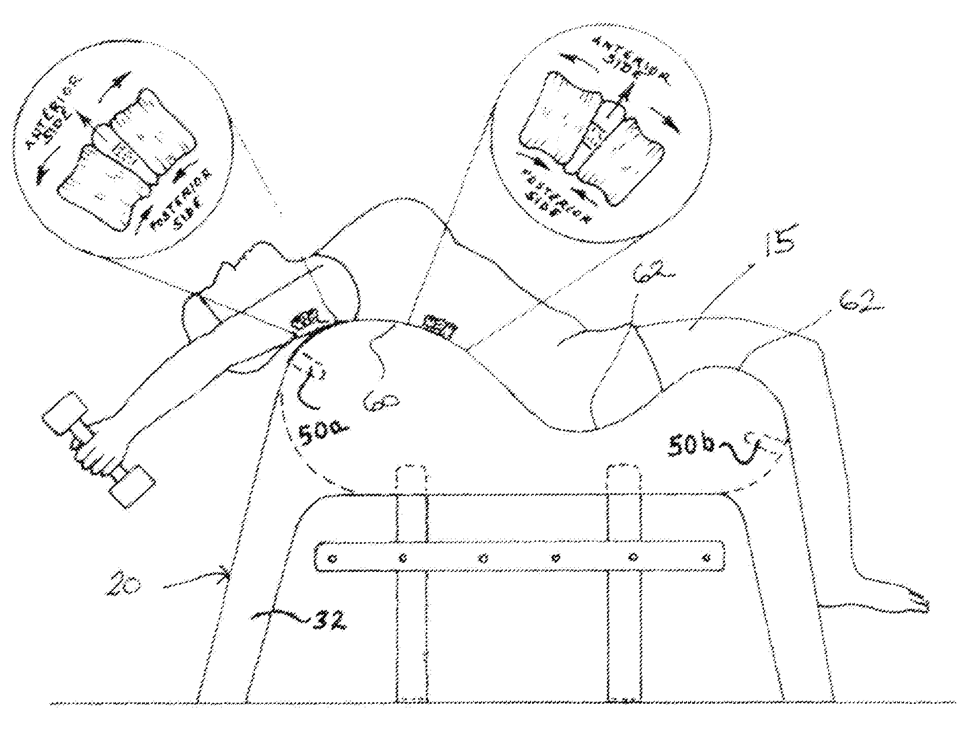 Backrest Apparatus Comprising a Concave Support Pad with Convex End Portions