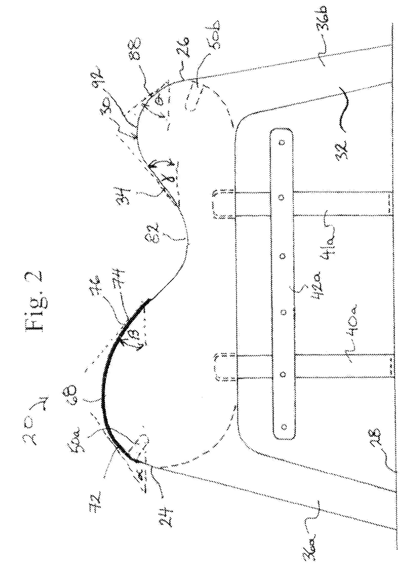 Backrest Apparatus Comprising a Concave Support Pad with Convex End Portions