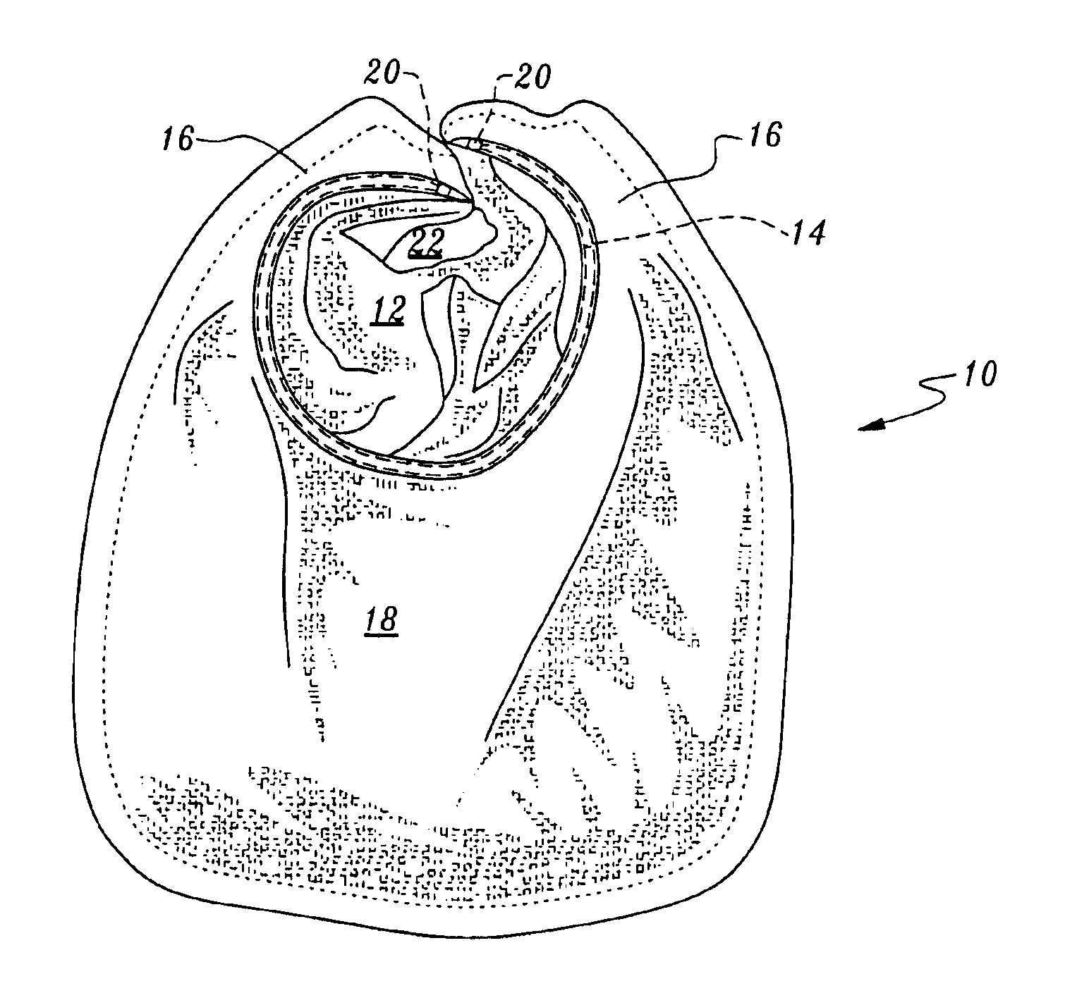 Protective bib with snug fitting feature