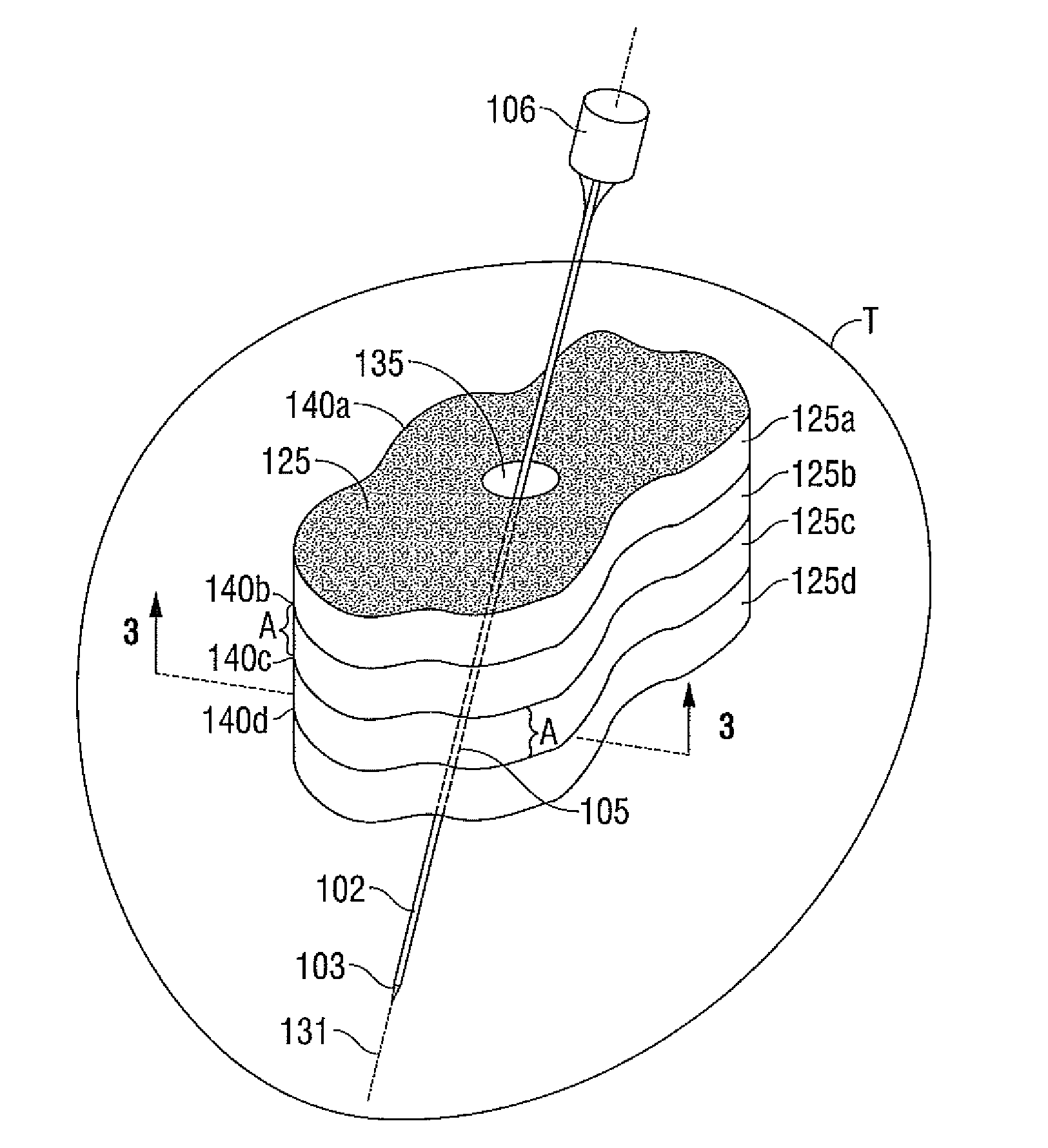 Method for ablation volume determination and geometric reconstruction