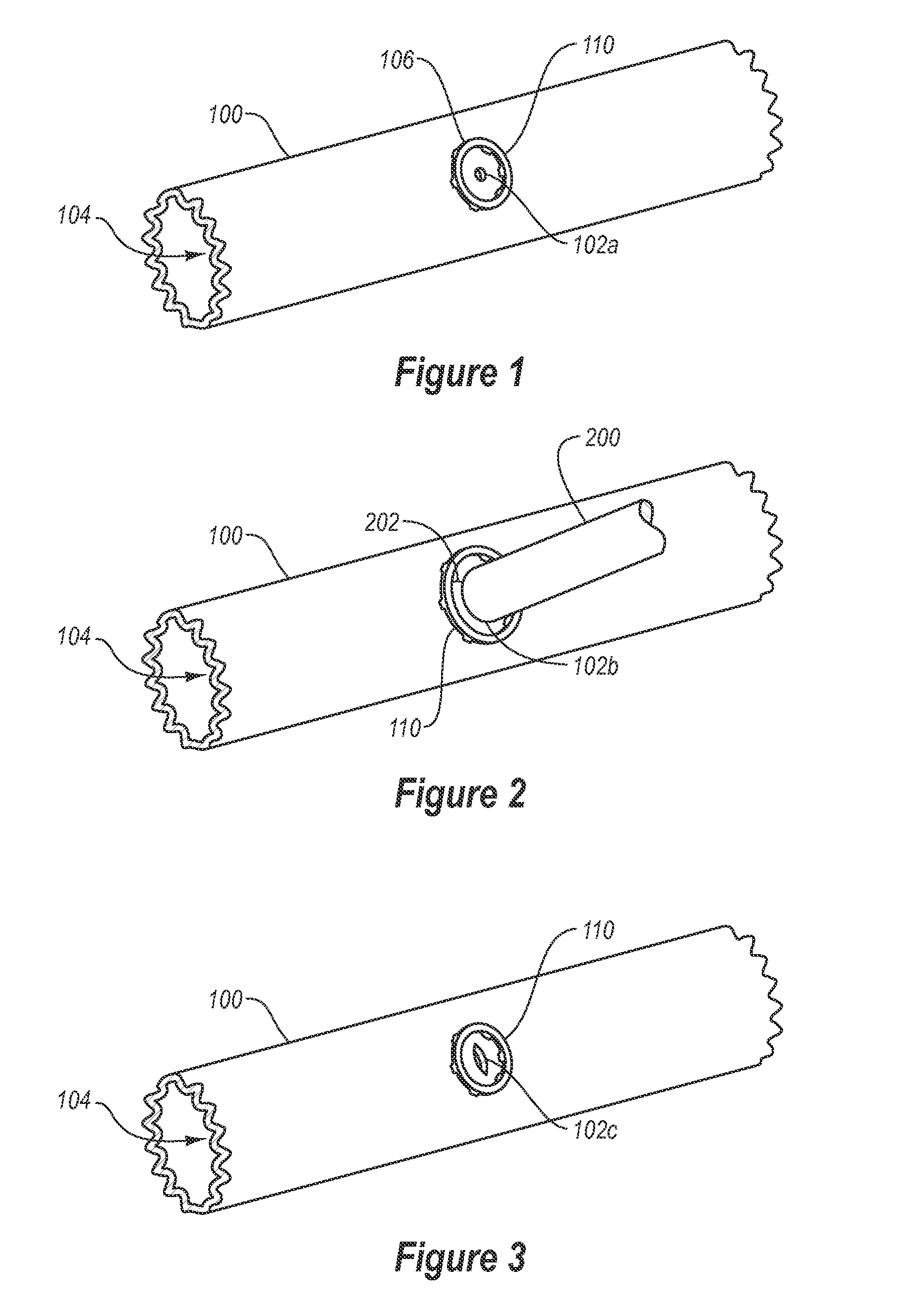 Scaffold device for preventing tissue trauma