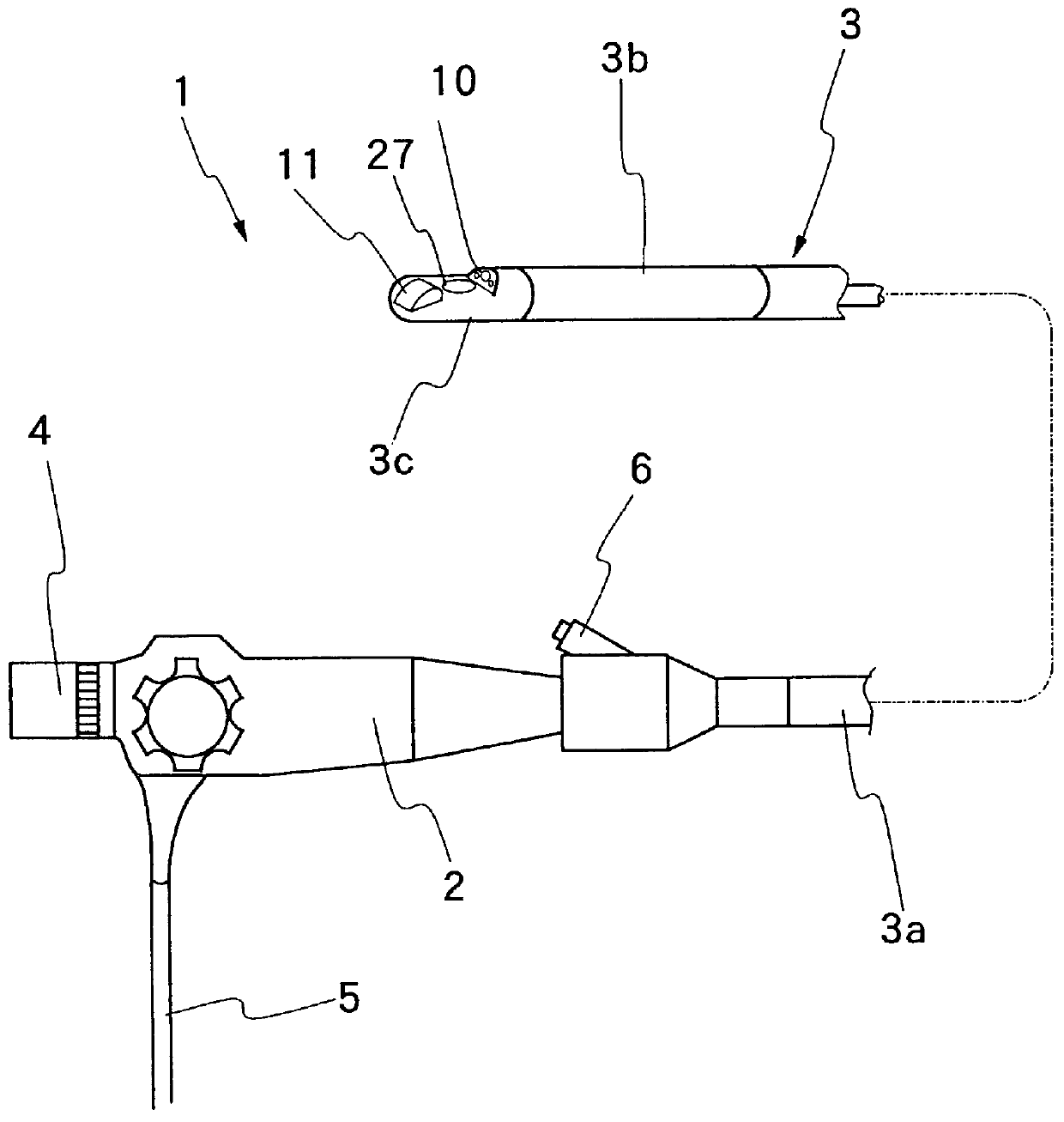 Ultrasound endoscope