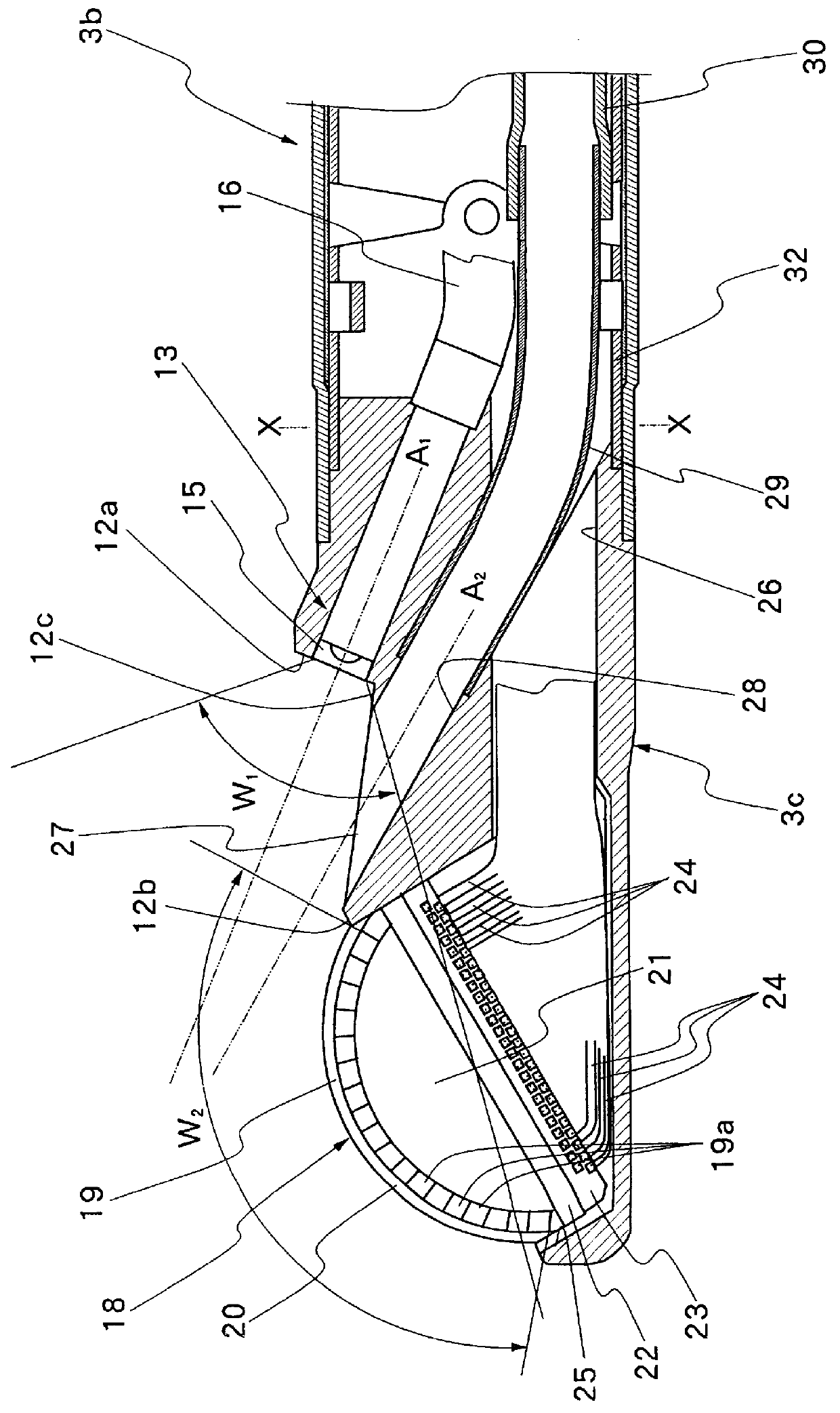 Ultrasound endoscope