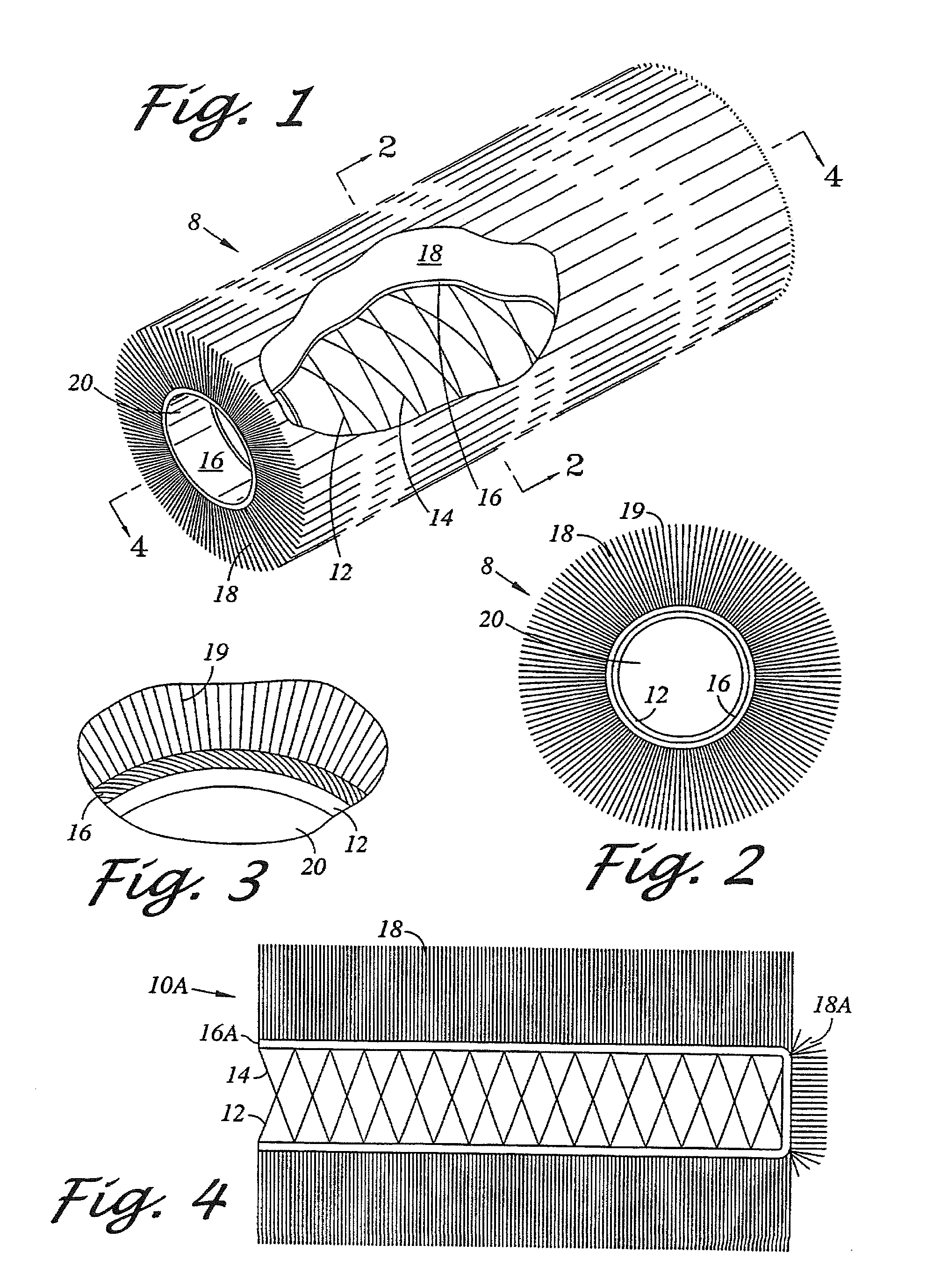 Large vessel stents and occluders