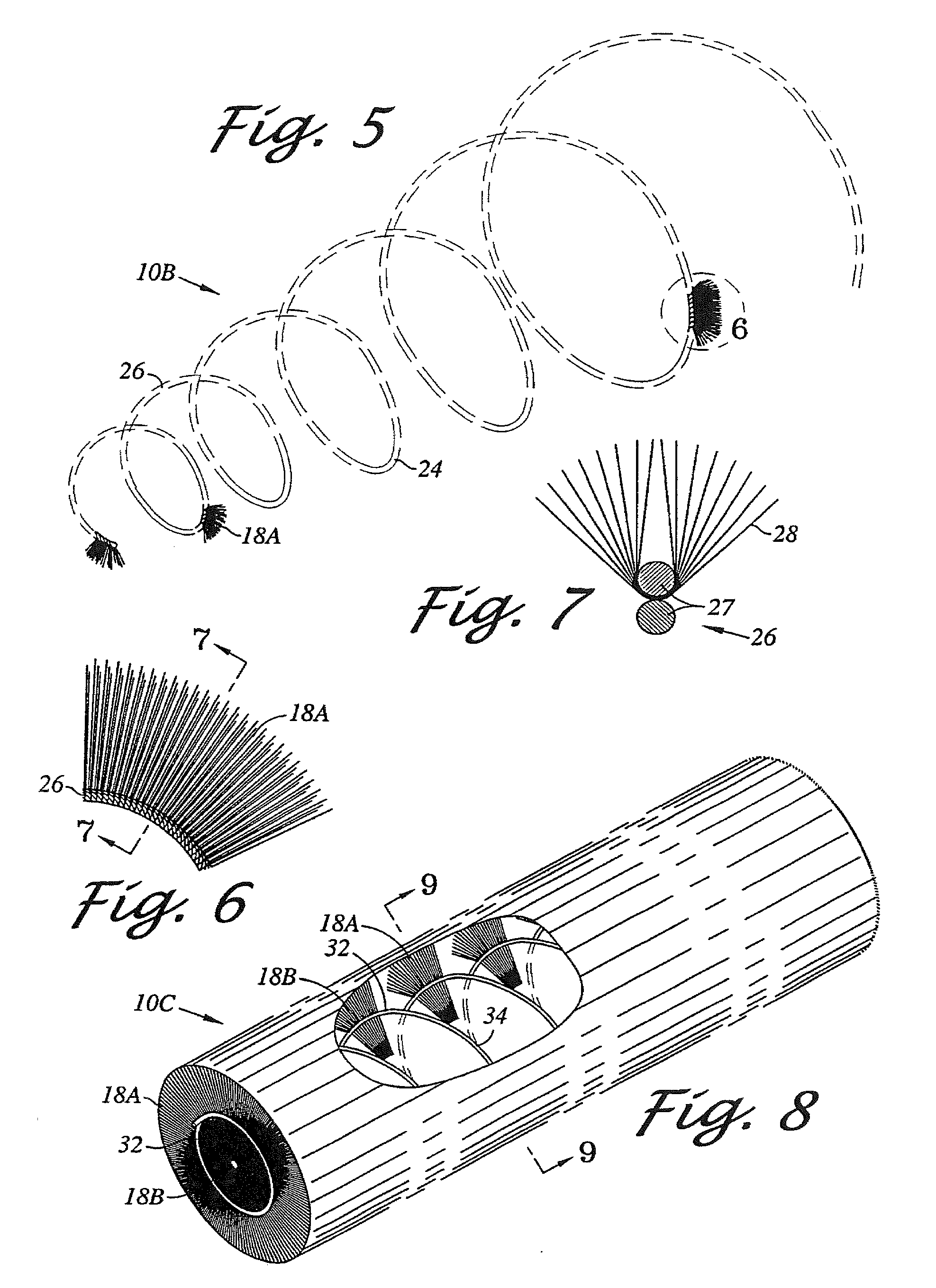 Large vessel stents and occluders