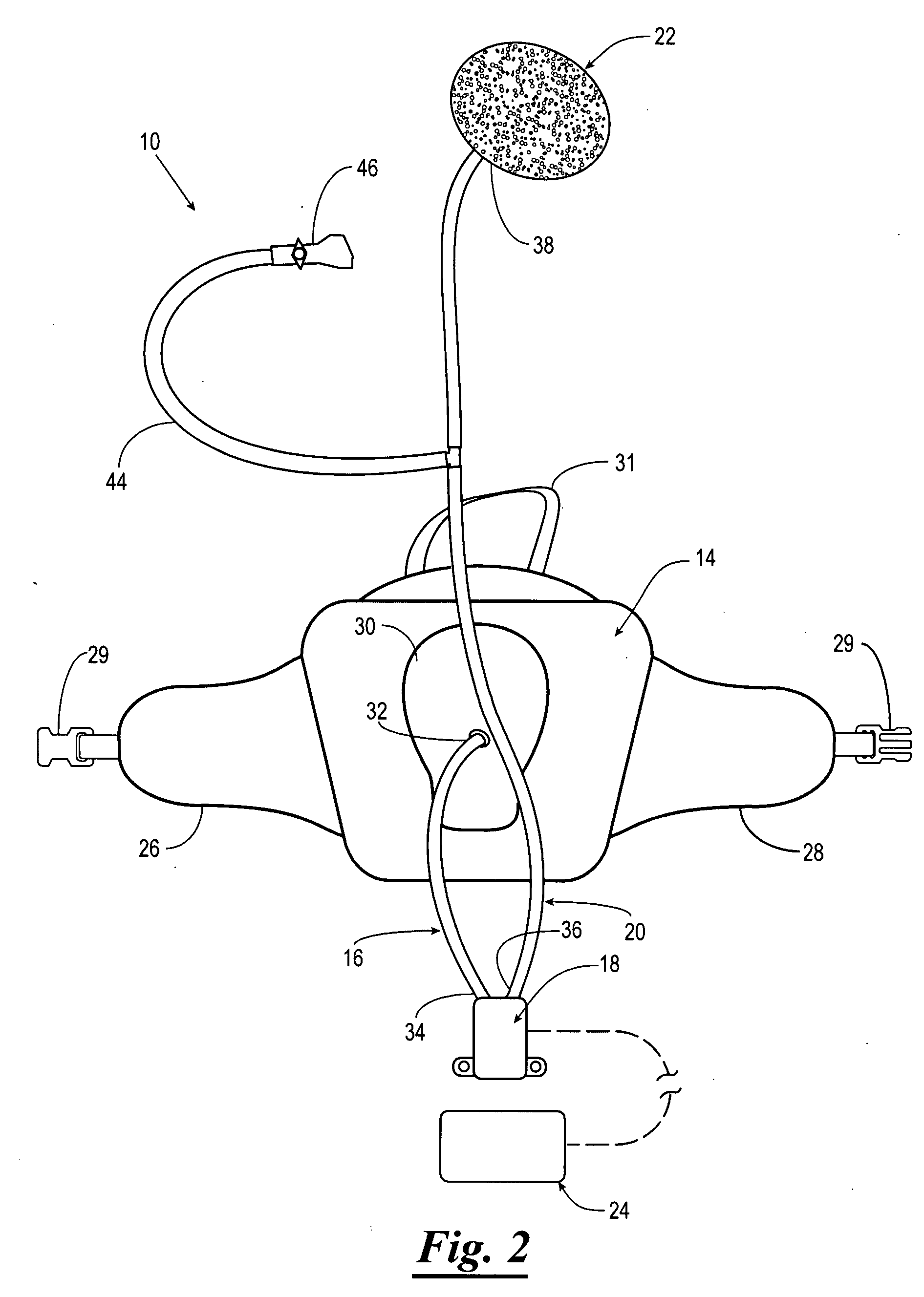 Hydration apparatus