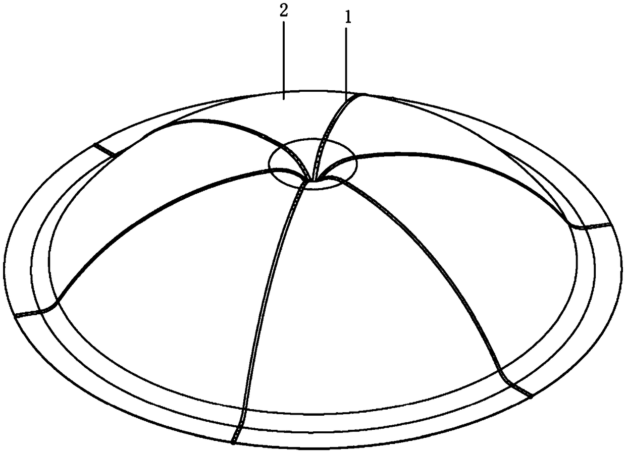 Fixing device for left ventricular aneurysm and system of device