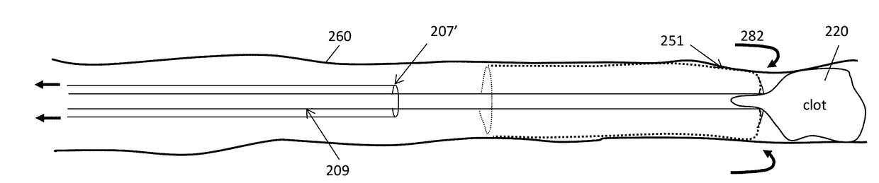 Clot-engulfing mechanical thrombectomy apparatuses