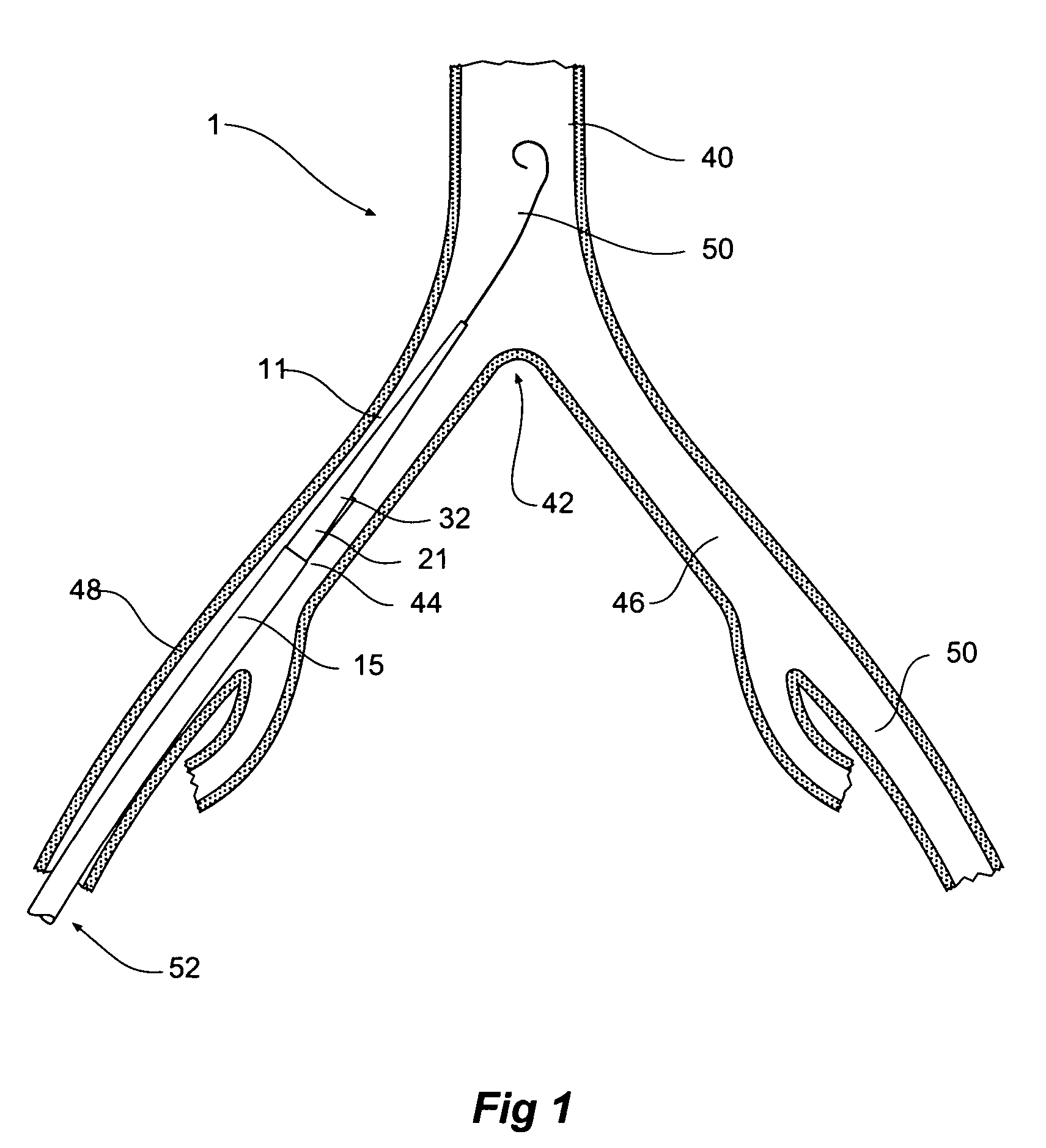 Introducer for an iliac side branch device