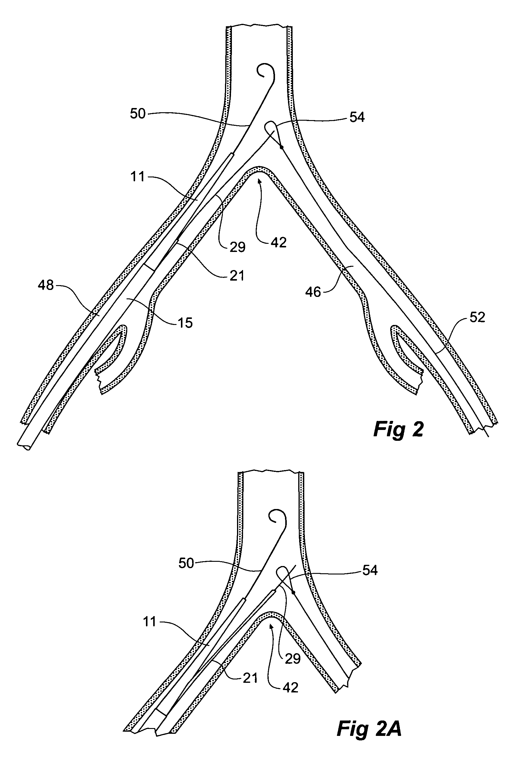 Introducer for an iliac side branch device