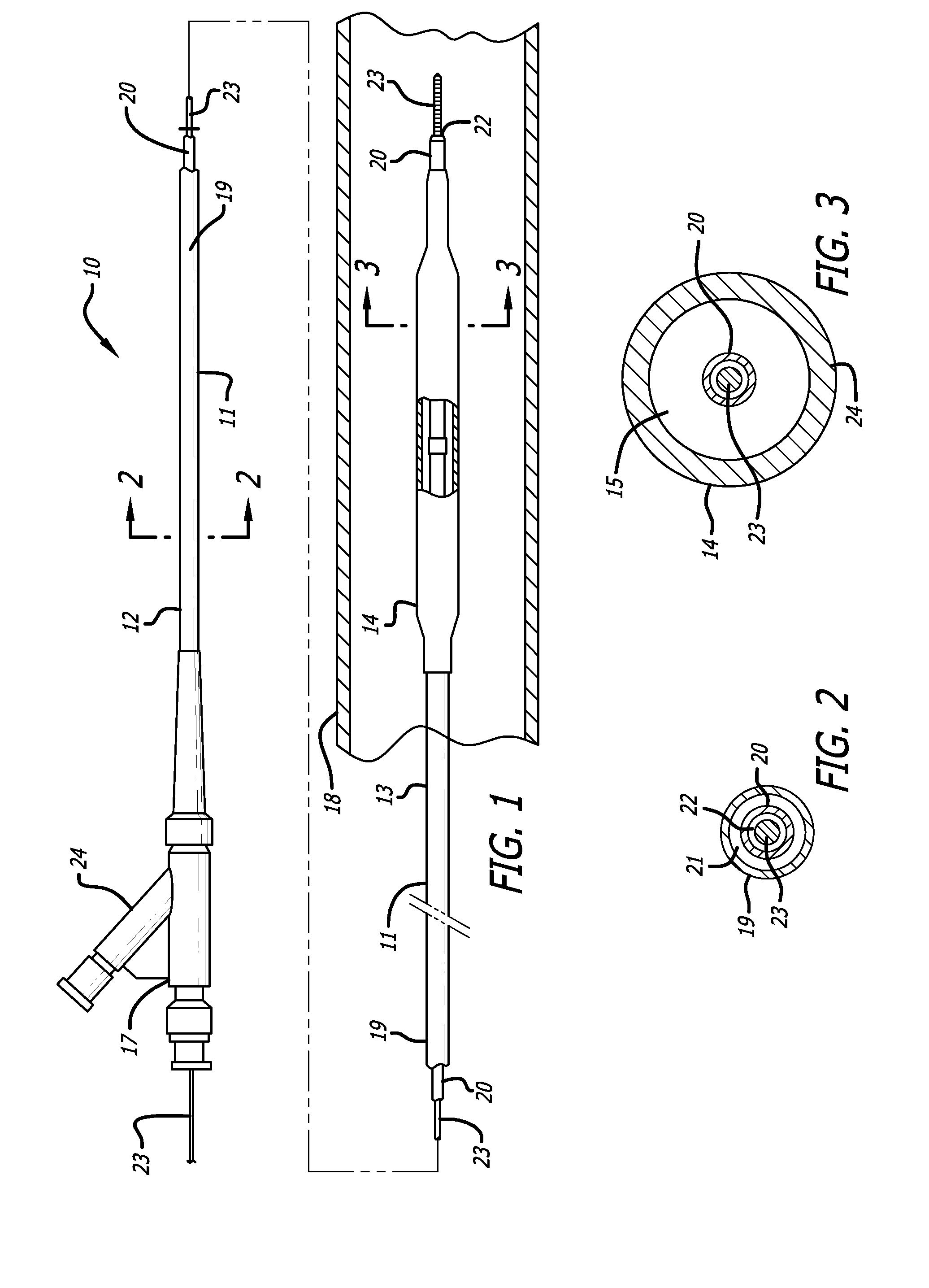 Robust catheter tubing