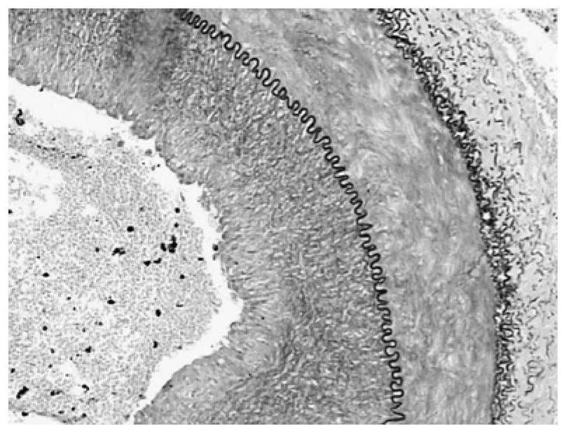 Chitosan nanoparticle composite as well as preparation method and application thereof