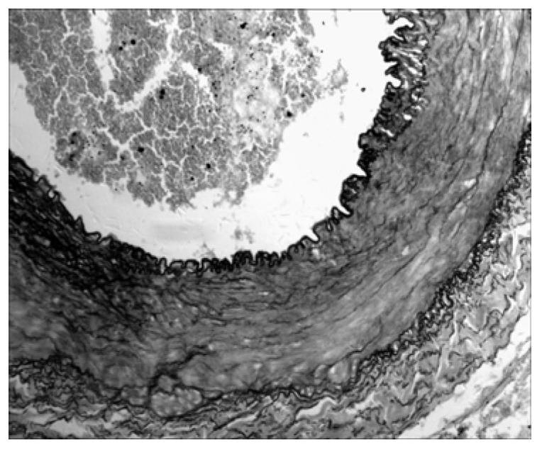 Chitosan nanoparticle composite as well as preparation method and application thereof