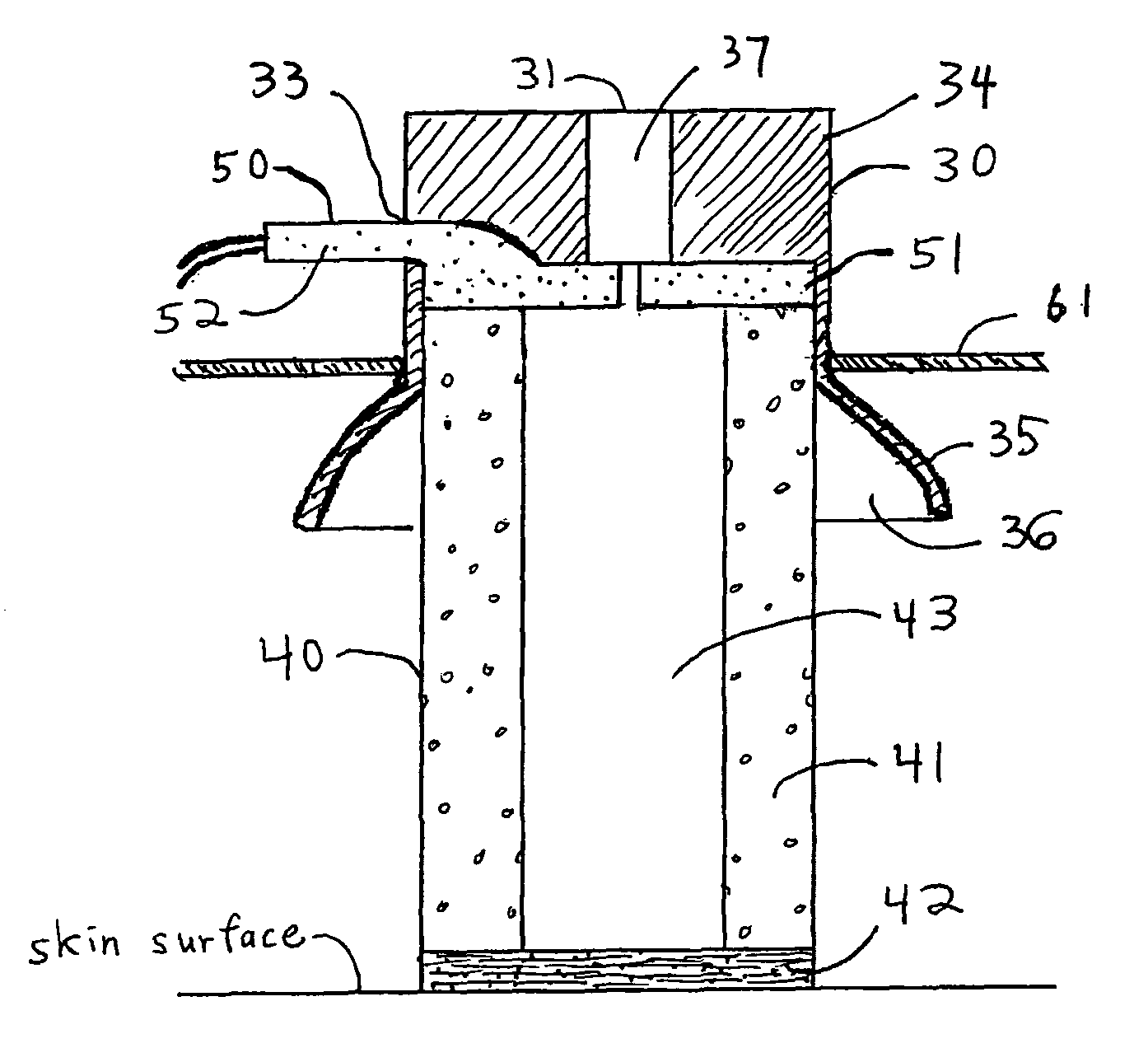 Sensor assembly with conductive bridge