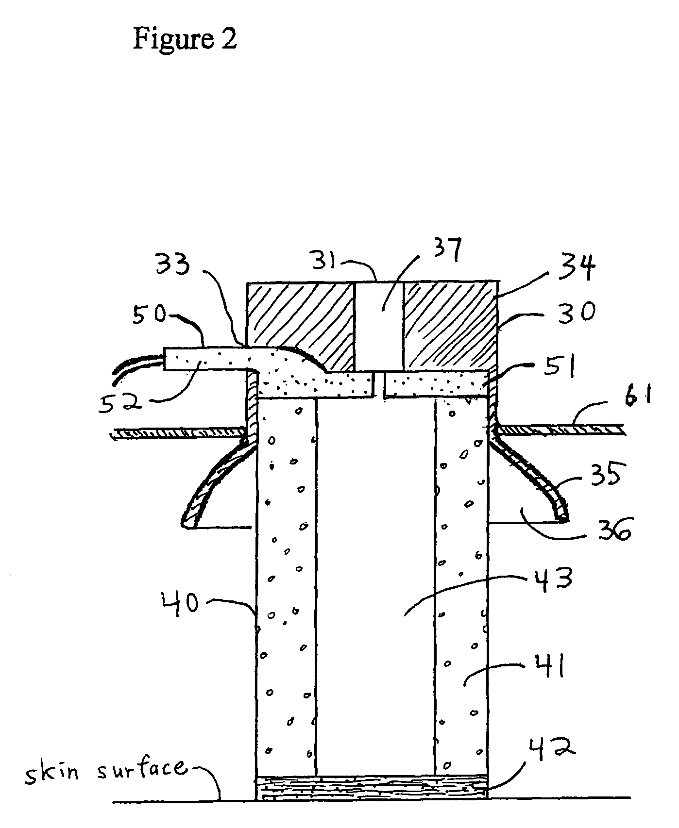 Sensor assembly with conductive bridge