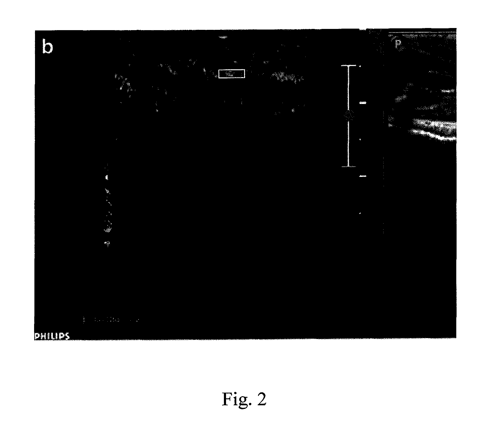 Method for quantifying drug delivery using contrast-enhanced ultrasound