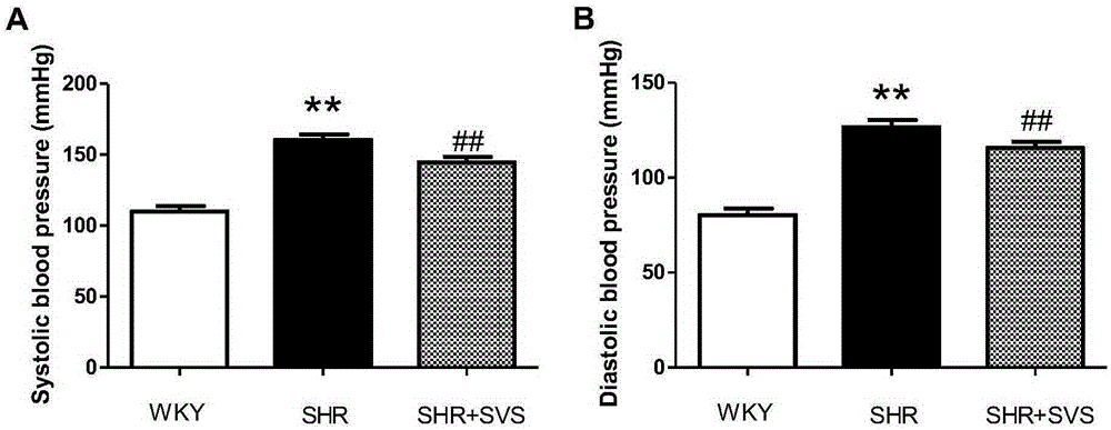 Application of stervioside in preparation of therapeutic drug and health product for prehypertension