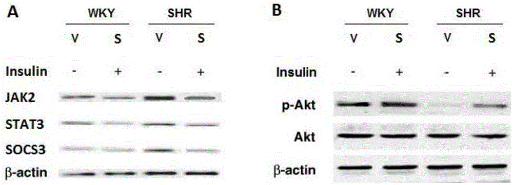 Application of stervioside in preparation of therapeutic drug and health product for prehypertension