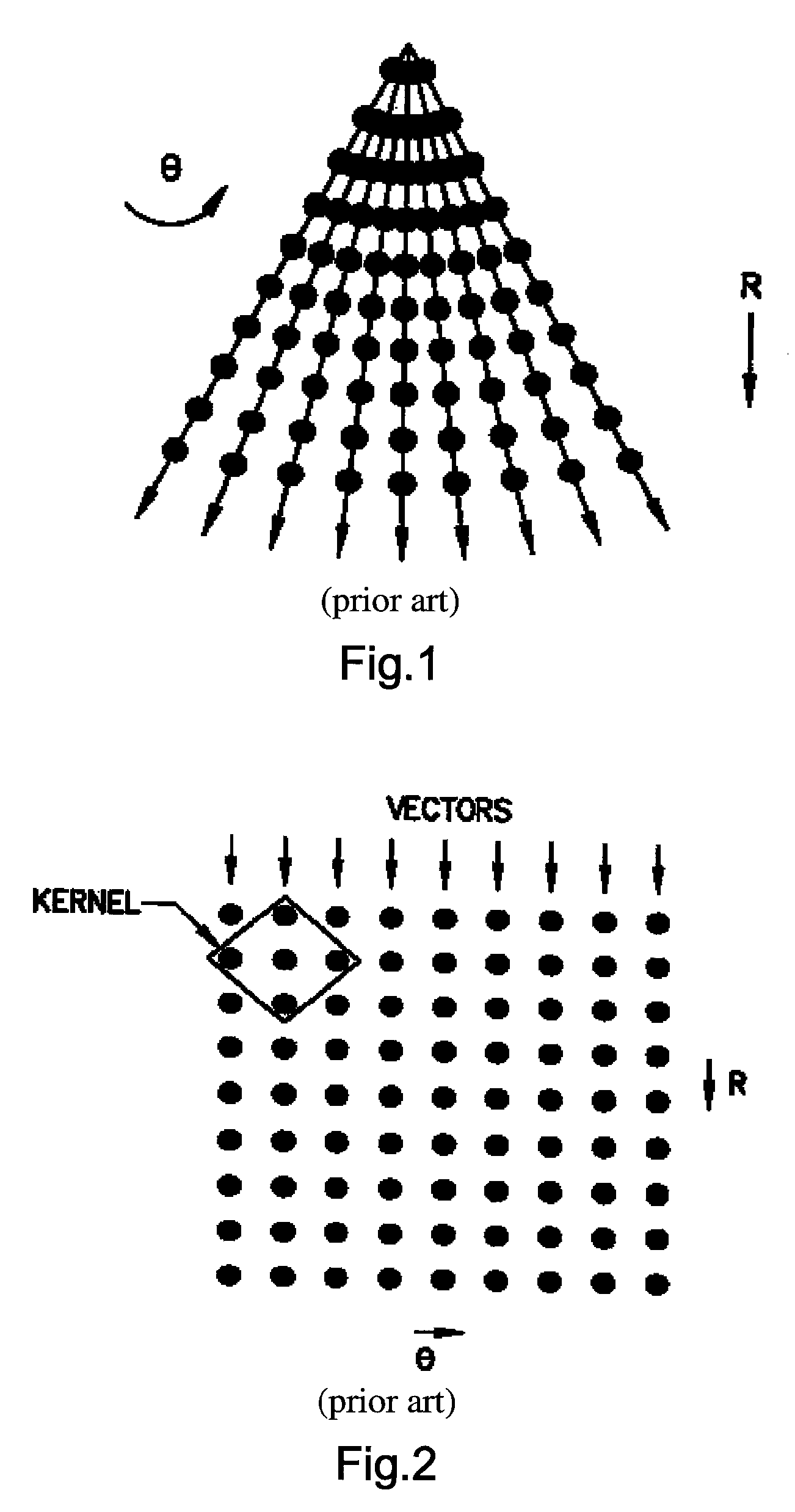 Method and apparatus for preprocessing ultrasound imaging