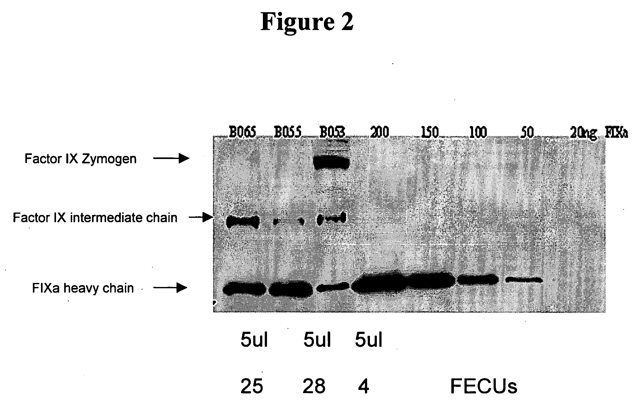 Factor IXa for the treatment of bleeding disorders