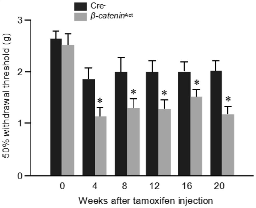 Application of inhibitor and pharmaceutical composition