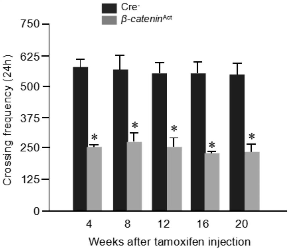 Application of inhibitor and pharmaceutical composition