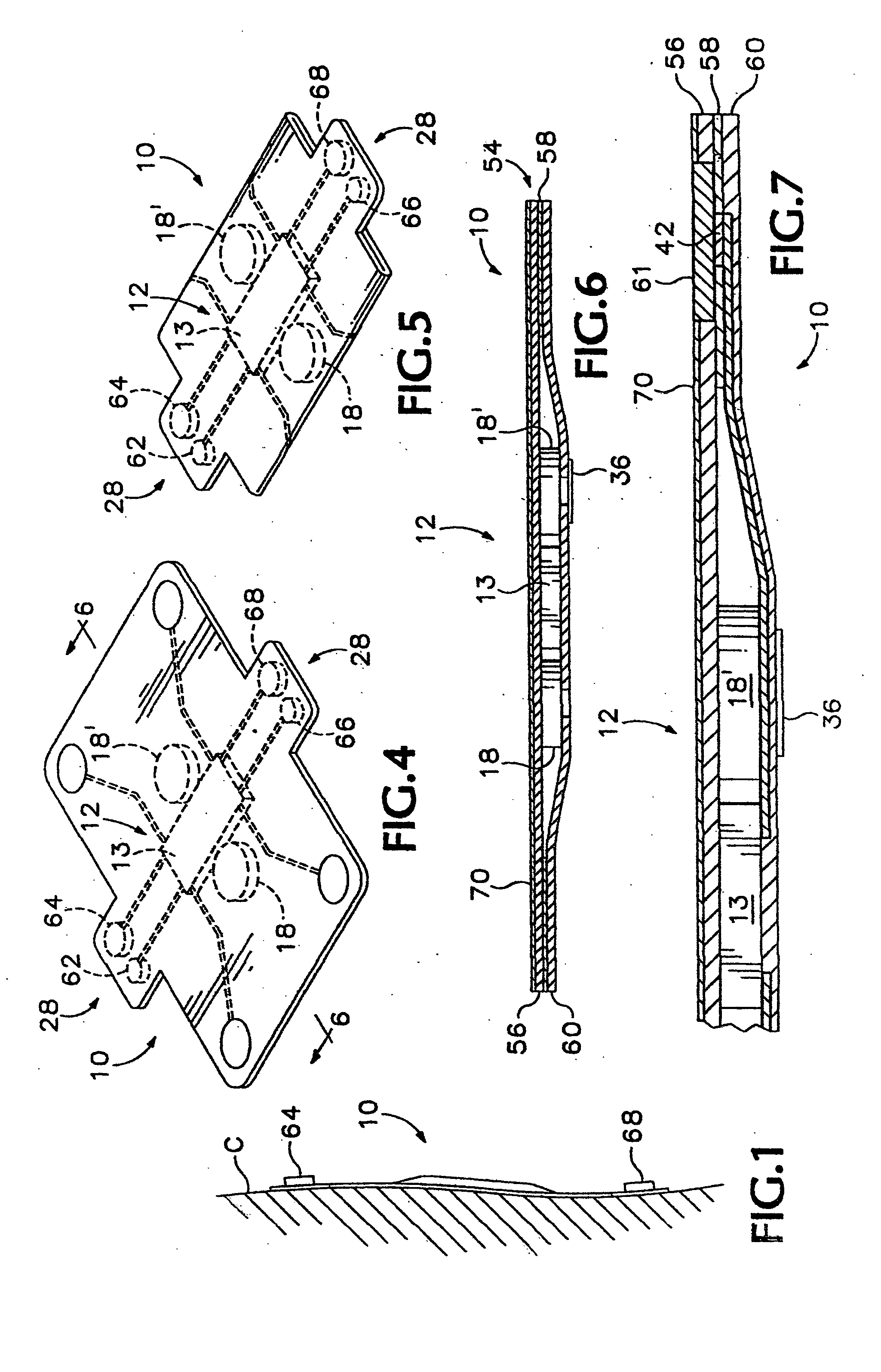 Non-invasive body composition monitor, system and method