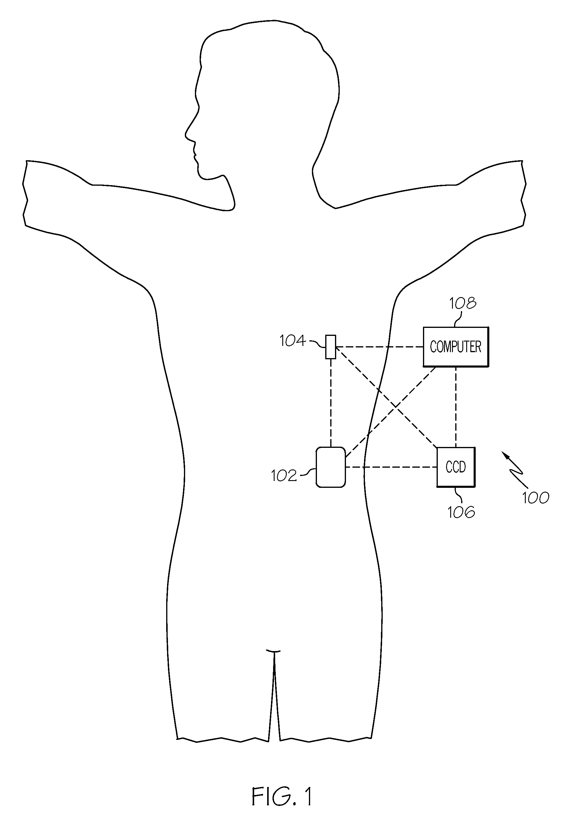 Occlusion detection using pulse-width modulation and medical device incorporating same