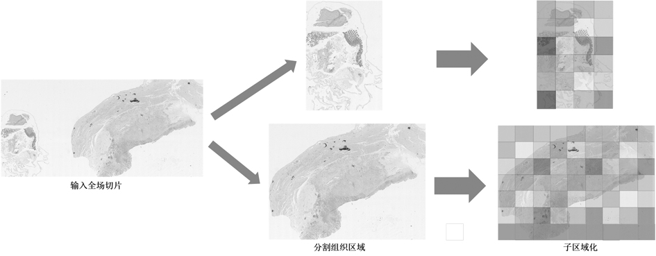 Tumor lymphatic infiltration detection method based on cascade network