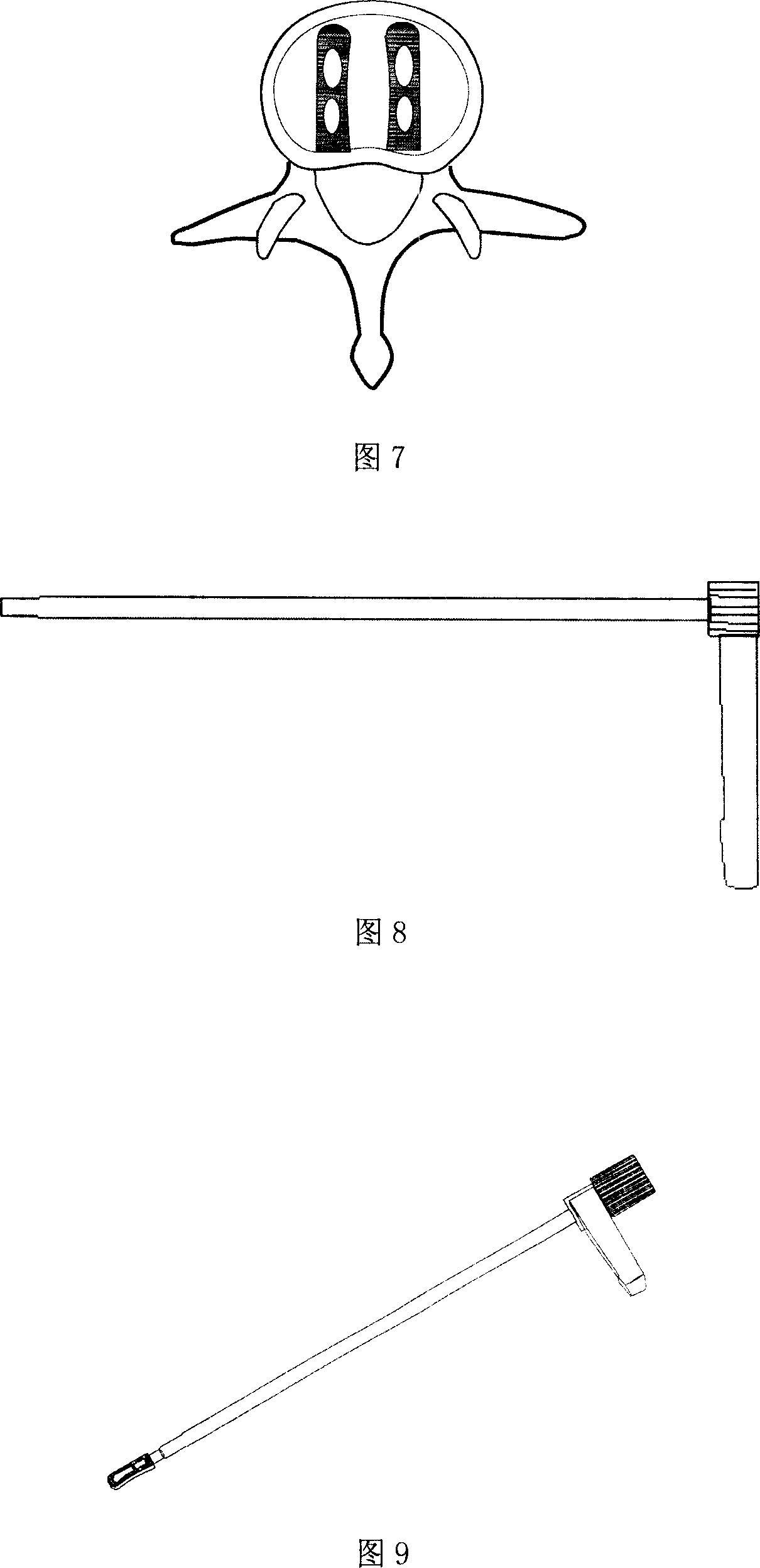 Minimally Invasive lumbar fusion device and its use method